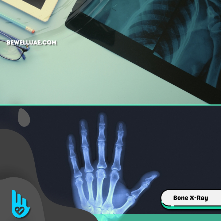 Bone Xray